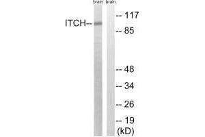 Western blot analysis of extracts from mouse brain cells, using ITCH (Ab-420) antibody. (ITCH anticorps  (Tyr420))