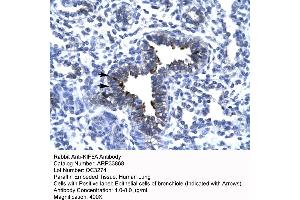 Rabbit Anti-KIF5A antibody   Paraffin Embedded Tissue: Human Lung cell Cellular Data: bronchiole epithelium of renal tubule Antibody Concentration: 4.