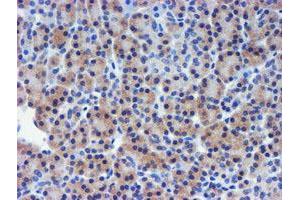 Image no. 2 for anti-Metalloproteinase Inhibitor 2 (TIMP2) antibody (ABIN1501394) (TIMP2 anticorps)