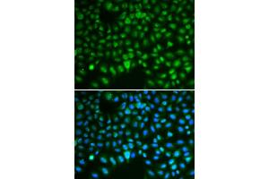 Immunofluorescence analysis of HeLa cells using DLG antibody (ABIN6130274, ABIN6139656, ABIN6139657 and ABIN6217626). (DLGAP5 anticorps  (AA 547-846))