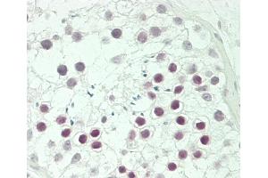 Formalin-fixed and paraffin-embedded H.