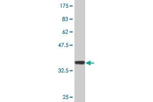 Western Blot detection against Immunogen (37.