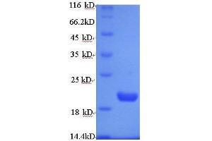 Vascular Endothelial Growth Factor A (VEGFA) (AA 27-190) protein (His tag) expressed in E.