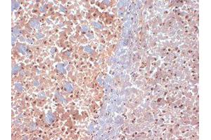 SAP97 Immunohistochemistry.