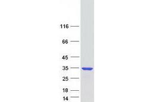 Validation with Western Blot