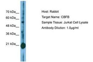 Image no. 1 for anti-Core-Binding Factor, beta Subunit (CBFB) (N-Term) antibody (ABIN6749810) (CBFB anticorps  (N-Term))