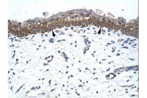 anti-Zinc Finger Protein 385A (ZNF385A) (AA 256-305) antibody