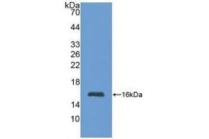 Detection of Recombinant MT1, Human using Polyclonal Antibody to Metallothionein 1 (MT1) (MT1 anticorps  (AA 1-61))
