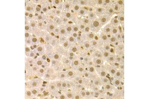 Immunohistochemistry of paraffin-embedded rat liver using SFN Antibody. (14-3-3 sigma/SFN anticorps  (AA 1-248))