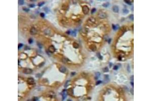 Used in DAB staining on fromalin fixed paraffin-embedded Kidney tissue (SNCG anticorps  (AA 1-115))