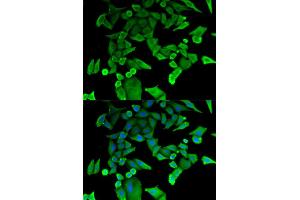 Immunofluorescence analysis of HeLa cells using TPT1 antibody. (TPT1 anticorps)