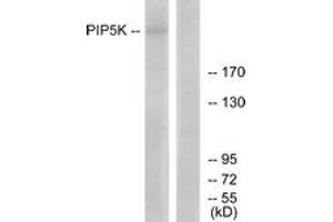Western Blotting (WB) image for anti-phosphoinositide Kinase, FYVE Finger Containing (PIKFYVE) (AA 71-120) antibody (ABIN2889821)