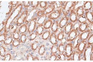 Immunohistochemistry of paraffin-embedded Mouse kidney using KIF4A Polyclonal Antibody at dilution of 1:100 (40x lens).