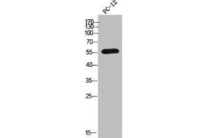 Western Blot analysis of PC-12 cells using CYP2A6 Polyclonal Antibody