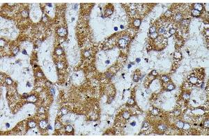 Immunohistochemistry of paraffin-embedded Human liver using APOC3 Polyclonal Antibody at dilution of 1:100 (40x lens). (APOC3 anticorps)