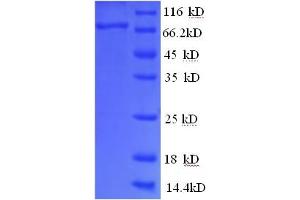 SDS-PAGE (SDS) image for Prostaglandin-Endoperoxide Synthase 2 (Prostaglandin G/H Synthase and Cyclooxygenase) (PTGS2) (AA 18-601), (partial) protein (His tag) (ABIN5710177)