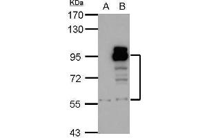 PDE4D anticorps  (C-Term)