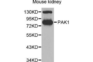 Western blot analysis of extracts of mouse kidney, using PAK1 antibody. (PAK1 anticorps)
