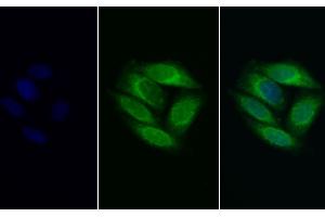 Detection of PSAP in Human HepG2 cell using Polyclonal Antibody to Prosaposin (PSAP)