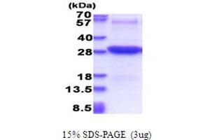 SDS-PAGE (SDS) image for Intercellular Adhesion Molecule 2 (ICAM2) (AA 22-223) protein (His tag) (ABIN7529265) (ICAM2 Protein (AA 22-223) (His tag))