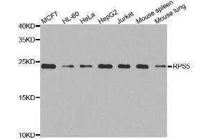 Western blot analysis of extracts of various cell lines, using RPS5 antibody. (RPS5 anticorps)