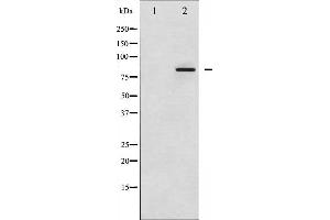 Western blot analysis of Ataxin 1 phosphorylation expression in Adriamycin treated HepG2 whole cell lysates,The lane on the left is treated with the antigen-specific peptide.