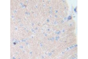 Used in DAB staining on fromalin fixed paraffin- embedded Kidney tissue