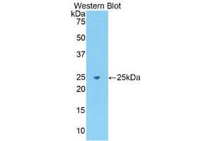 Western Blotting (WB) image for anti-Fibronectin (AA 355-558) antibody (ABIN1078037) (Fibronectin anticorps  (AA 355-558))