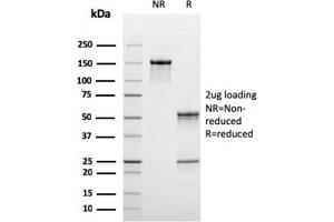 SDS-PAGE Analysis Purified C1QB Mouse Monoclonal Antibody (C1QB/2965). (C1QB anticorps  (AA 41-188))