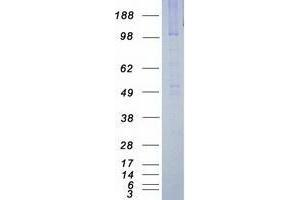 Validation with Western Blot