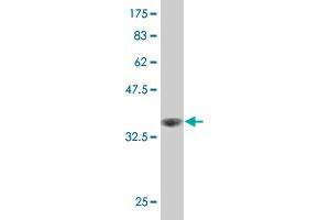 Western Blot detection against Immunogen (36. (LIM Domain Kinase 1 anticorps  (AA 548-647))