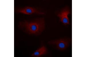 Immunofluorescent analysis of PAK1 staining in HEK293T cells. (PAK1 anticorps  (Center))