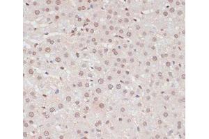 Immunohistochemistry of paraffin-embedded Rat liver using Phospho-STAT1(S727) Polyclonal Antibody at dilution of 1:100 (40x lens). (STAT1 anticorps  (pSer727))