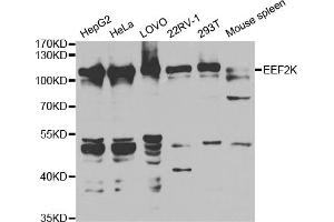Western blot analysis of extracts of various cell lines, using EEF2K antibody. (EEF2K anticorps)