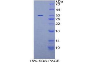 SDS-PAGE analysis of Human PLEKHA1 Protein.