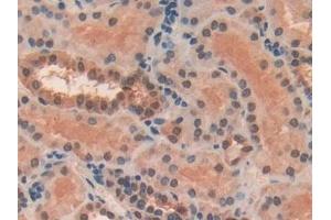 Detection of FZD1 in Human Kidney Tissue using Polyclonal Antibody to Frizzled Homolog 1 (FZD1) (FZD1 anticorps  (AA 117-322))
