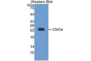 Western Blotting (WB) image for anti-Peroxiredoxin 1 (PRDX1) (AA 1-199) antibody (ABIN1175811) (Peroxiredoxin 1 anticorps  (AA 1-199))