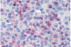 Human Spleen (formalin-fixed, paraffin-embedded) stained with CXCR4 antibody ABIN305765 at 5 ug/ml followed by biotinylated goat anti-rabbit IgG secondary antibody ABIN481713, alkaline phosphatase-streptavidin and chromogen. (CXCR4 anticorps  (AA 182-196))