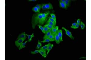 Immunofluorescence staining of HepG2 cells with ABIN7147911 at 1:133, counter-stained with DAPI.