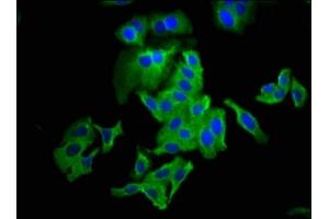 Immunofluorescence staining of HepG2 cells with ABIN7147911 at 1:133, counter-stained with DAPI. (Claudin 6 anticorps  (AA 182-220))