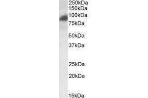 AP23769PU-N RAB11FIP1 antibody staining of HeLa lysate at 0. (RAB11FIP1 anticorps  (Internal Region))