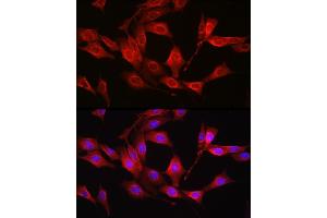Immunofluorescence analysis of NIH/3T3 cells using [KO Validated] Glutathione Synthetase (GSS) Rabbit pAb (ABIN7267451) at dilution of 1:100 (40x lens).