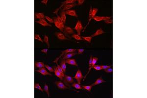 Immunofluorescence analysis of NIH/3T3 cells using [KO Validated] Glutathione Synthetase (GSS) Rabbit pAb (ABIN7267451) at dilution of 1:100 (40x lens). (Glutathione Synthetase anticorps  (AA 373-474))