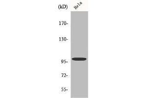 Western Blot analysis of HeLa cells using Catenin-α E/N Polyclonal Antibody (CTNNA2 anticorps  (C-Term))