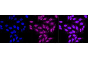 Immunocytochemical staining of HepG2 cells with Histone H2B (formyl K108) antibody (ABIN7798947), 1:1,000).