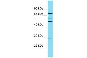 Western Blotting (WB) image for anti-Cortactin (CTTN) (N-Term) antibody (ABIN2774002) (Cortactin anticorps  (N-Term))