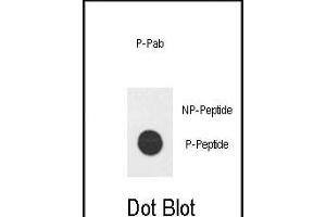 Dot blot analysis of Phospho-hE2F1- Pab (ABIN650836 and ABIN2839802) on nitrocellulose membrane. (E2F1 anticorps  (His357))