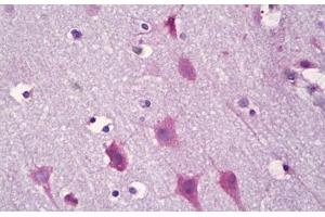 Anti-KCNIP3 / CSEN antibody IHC staining of human brain, cortex neurons. (DREAM anticorps  (AA 29-78))