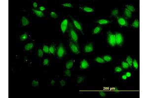 Immunofluorescence of monoclonal antibody to HDAC5 on HeLa cell.