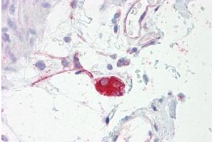 Anti-ADRA2A antibody IHC staining of human colon, submucosal plexus. (ADRA2A anticorps  (AA 331-380))